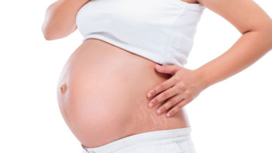 علامات التمدد خلال الحمل