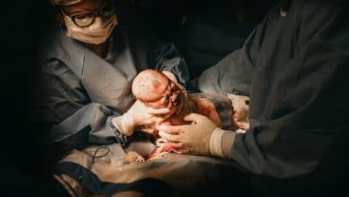 أشهر الخرافات عن الولادة القيصرية