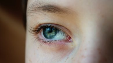 اسباب جفاف العين عند الأطفال