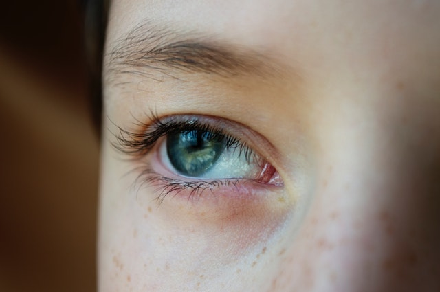 اسباب جفاف العين عند الأطفال